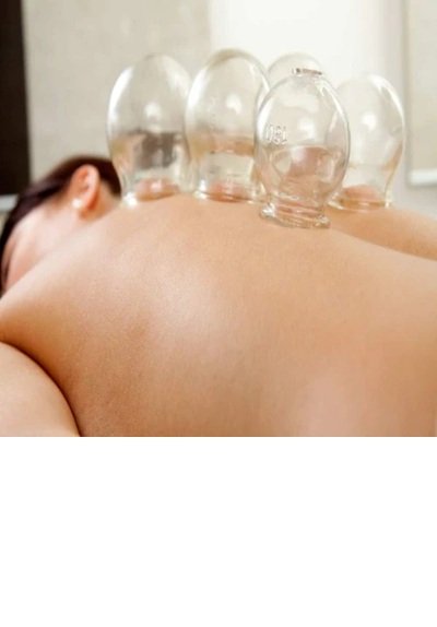 Acupressure Vacuum Fire Glass Cupping Therapy Kit – Traditional Chinese Cupping for Pain Relief & Muscle Relaxation - Image 3